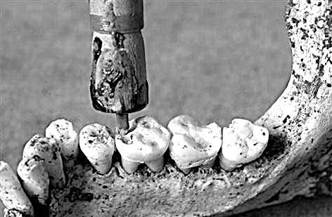 Из истории зубоврачевания, или Кто лечил зубы российским монархам