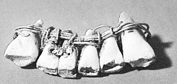 Из истории зубоврачевания, или Кто лечил зубы российским монархам
